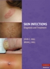 Skin Infections : Diagnosis and Treatment - eBook