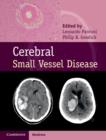 Cerebral Small Vessel Disease - eBook