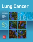 Lung Cancer:  Standards of Care - eBook