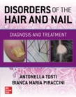 Disorders of the Hair and Nail: Diagnosis and Treatment - Book
