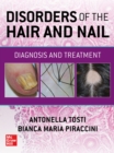 Disorders of the Hair and Nail: Diagnosis and Treatment - eBook