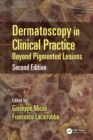 Dermatoscopy in Clinical Practice : Beyond Pigmented Lesions - eBook