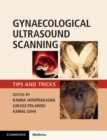Gynaecological Ultrasound Scanning : Tips and Tricks - Book
