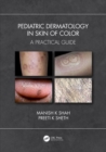 Pediatric Dermatology in Skin of Color : A Practical Guide - eBook