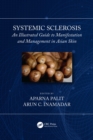Systemic Sclerosis : An Illustrated Guide to Manifestation and Management in Asian Skin - eBook