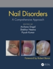 Nail Disorders : A Comprehensive Approach - eBook