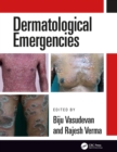 Dermatological Emergencies - eBook