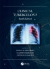 Clinical Tuberculosis - eBook