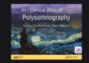 Clinical Atlas of Polysomnography - eBook