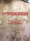 Hypopigmentation - eBook