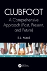 Clubfoot : A Comprehensive Approach (Past, Present, and Future) - eBook