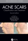Acne Scars : Classification and Treatment, Second Edition - eBook