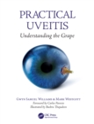 Practical Uveitis : Understanding the Grape - eBook