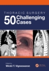 Thoracic Surgery: 50 Challenging cases - eBook