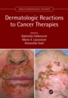 Dermatologic Reactions to Cancer Therapies - eBook