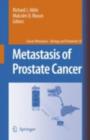 Metastasis of Prostate Cancer - eBook