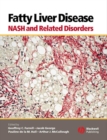 Fatty Liver Disease : NASH and Related Disorders - eBook