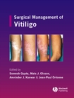 Surgical Management of Vitiligo - eBook