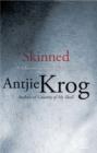Skinned: Poems - eBook