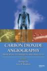 Carbon Dioxide Angiography : Principles, Techniques, and Practices - eBook