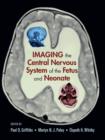 Imaging the Central Nervous System of the Fetus and Neonate - eBook