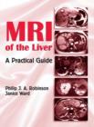 MRI of the Liver : A Practical Guide - eBook