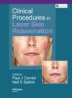 Clinical Procedures in Laser Skin Rejuvenation - eBook