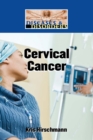 Cervical Cancer - eBook