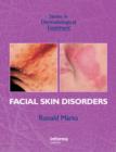 Facial Skin Disorders - eBook