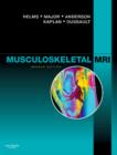 Musculoskeletal MRI E-Book - eBook
