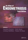 Atlas of Endometriosis - eBook