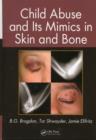 Child Abuse and its Mimics in Skin and Bone - eBook
