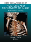 Forensic Pathology of Fractures and Mechanisms of Injury : Postmortem CT Scanning - eBook