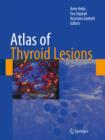 Atlas of Thyroid Lesions - eBook