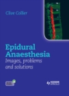 Epidural Anaesthesia: Images, Problems and Solutions - eBook