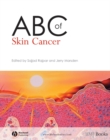 ABC of Skin Cancer - eBook