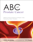 ABC of Prostate Cancer - eBook
