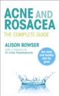 Acne and Rosacea : The Complete Guide - eBook