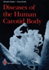 Diseases of the Human Carotid Body - eBook