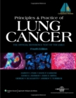 Principles and Practice of Lung Cancer : The Official Reference Text of the International Association for the Study of Lung Cancer (IASLC) - eBook