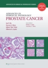 H27Advances in Surgical Pathology: Prostate Cancer - eBook