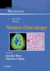 Neuro-Oncology : Blue Books of Neurology Series - eBook