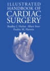 Illustrated Handbook of Cardiac Surgery - eBook