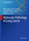 Molecular Pathology of Lung Cancer - eBook