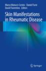 Skin Manifestations in Rheumatic Disease - eBook