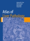 Atlas of Liver Pathology - eBook
