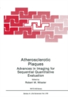 Atherosclerotic Plaques : Advances in Imaging for Sequential Quantitative Evaluation - eBook