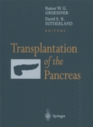 Transplantation of the Pancreas - eBook