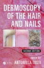 Dermoscopy of the Hair and Nails - eBook