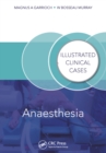 Anaesthesia : Illustrated Clinical Cases - eBook